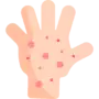 rash